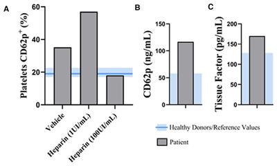 A case report of vaccine-induced immune thrombotic thrombocytopenia (VITT) with genetic analysis